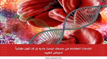 الكدمات المفاجئة على جسمك ليست عادية بل قد تكون مؤشراً لأمراض خطيرة